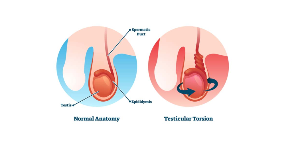 Ular erkaklarning siklariga narsalarni yopishtiradilar